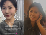‘한채영 닮은꼴’ 28기 영숙 “반복되는 오해” 성형 시술 입 열었다